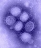 Considerente generale legate de actuala pandemie de gripa porcina