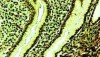 Citotoxina vacuolară-asul din genomul lui H. Pylori