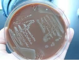 Purpura fulminans sau sindromul Waterhouse- Friderichsen
