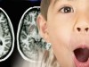 Modificarile creierului la copiii cu ADHD relevate de o tehnica noua