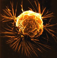 Celula canceroasa
