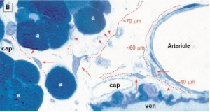Interstitial Cells of Cajal