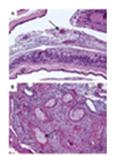 Placental Vascular Pathology in Preeclampsia (Hematoxylin and Eosin, ×10)