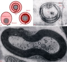 Celula Schwann, sectiune si imagine de microscopie electronica