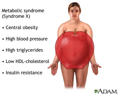 Sindrom metabolic