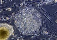 Celule stem recoltate din testicul