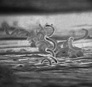 Treponema Pallidum
